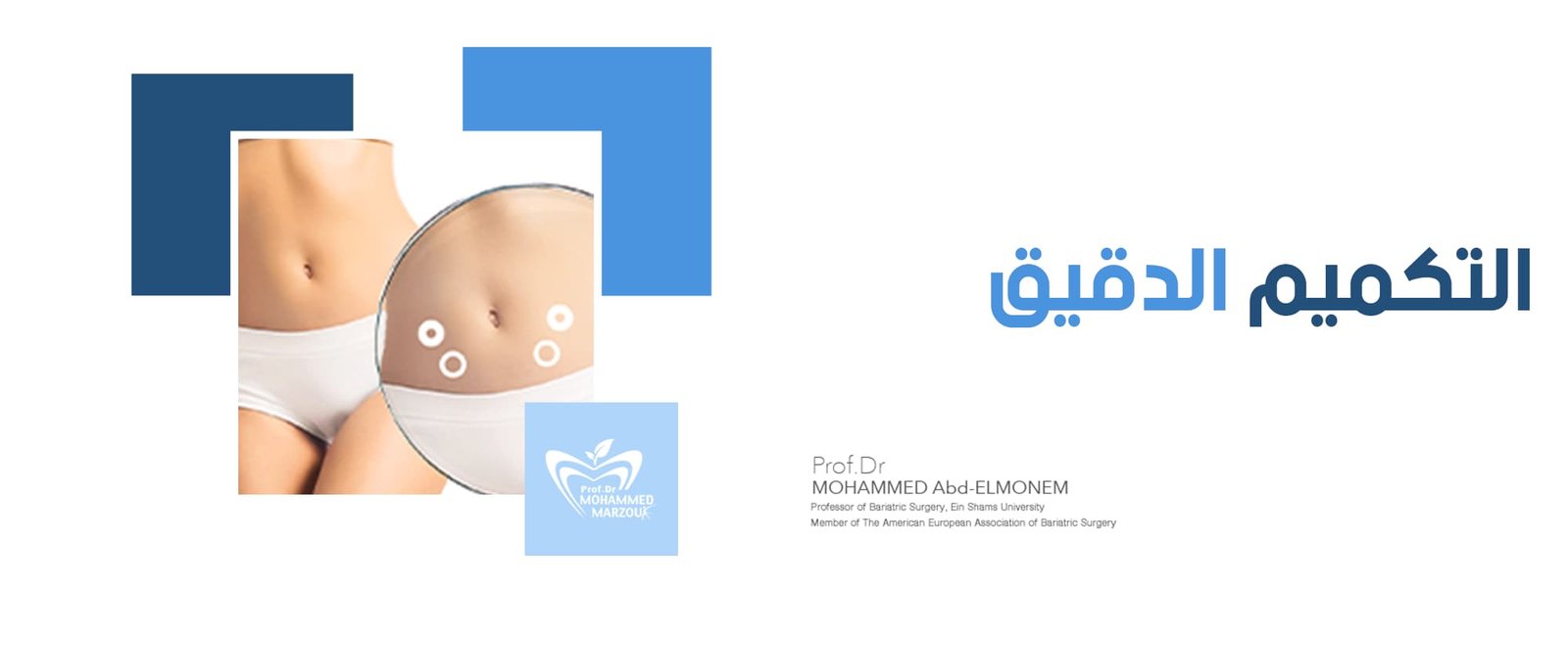 التكميم الدقيق