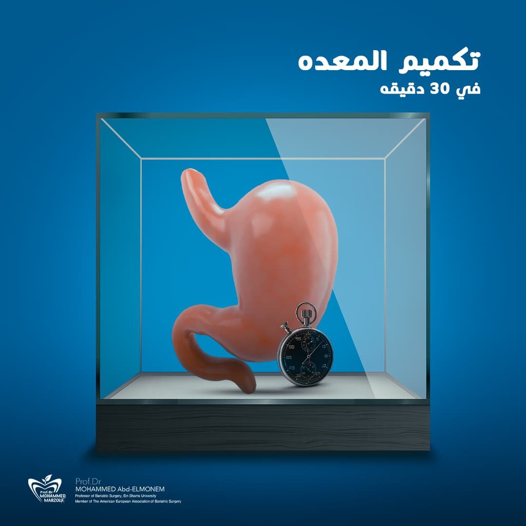 تكميم المعدة بالمنظار